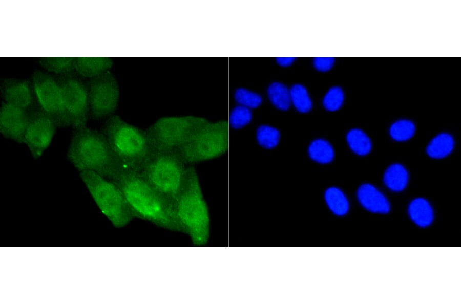 Immunofluorescence - Anti-Acetyl-TP53-K370 mAb Antibody (A11012) - Antibodies.com
