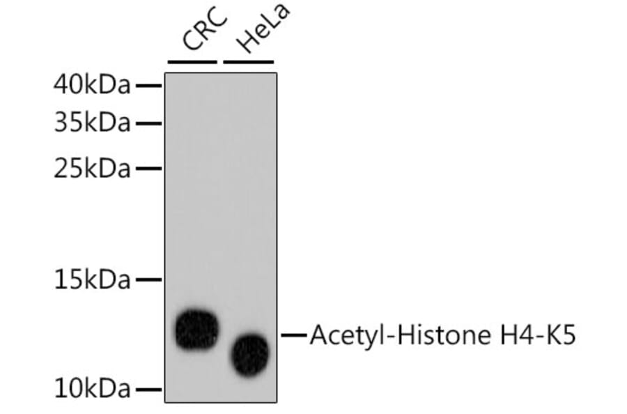 Western Blot - Anti-Acetyl-Histone H4-K5 mAb Antibody (A11015) - Antibodies.com