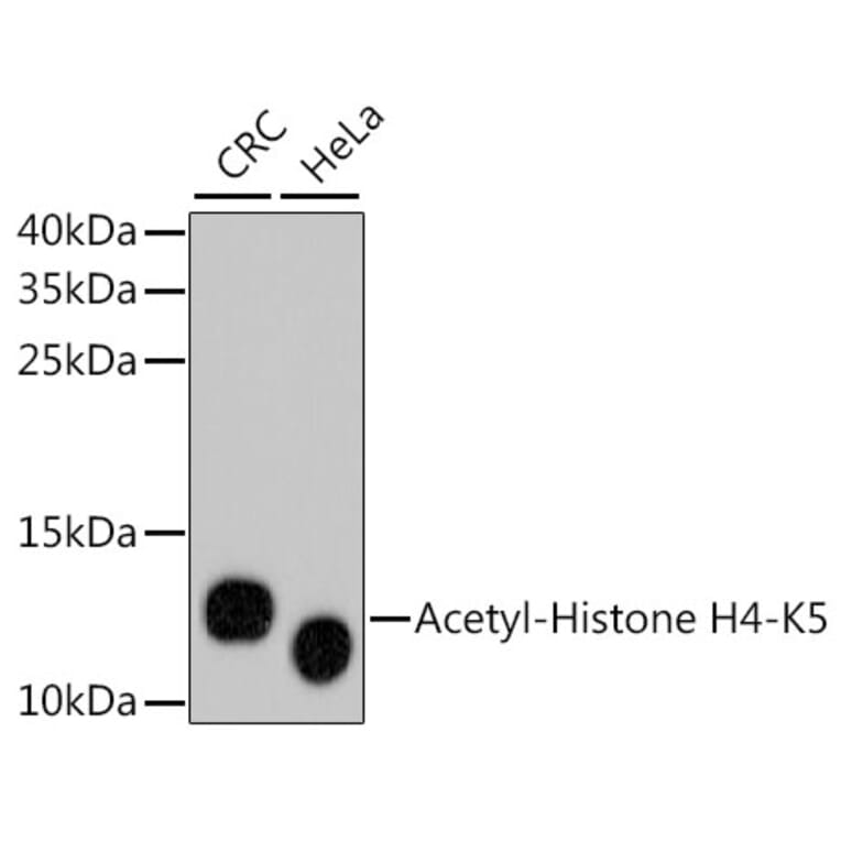 Western Blot - Anti-Acetyl-Histone H4-K5 mAb Antibody (A11015) - Antibodies.com