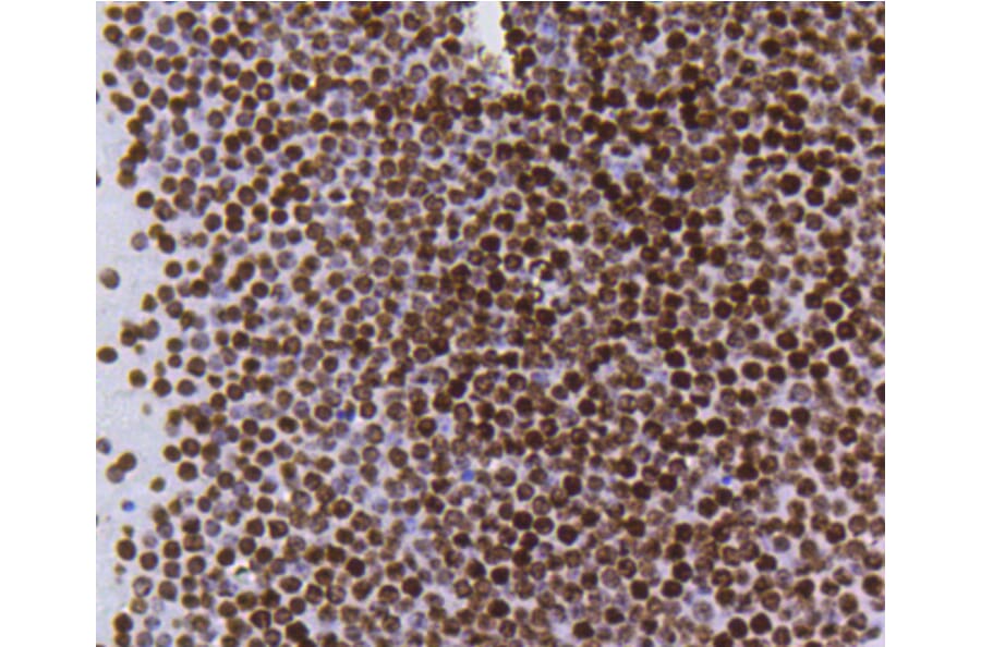 Immunohistochemistry - Anti-Acetyl-Histone H4-K5 mAb Antibody (A11015) - Antibodies.com