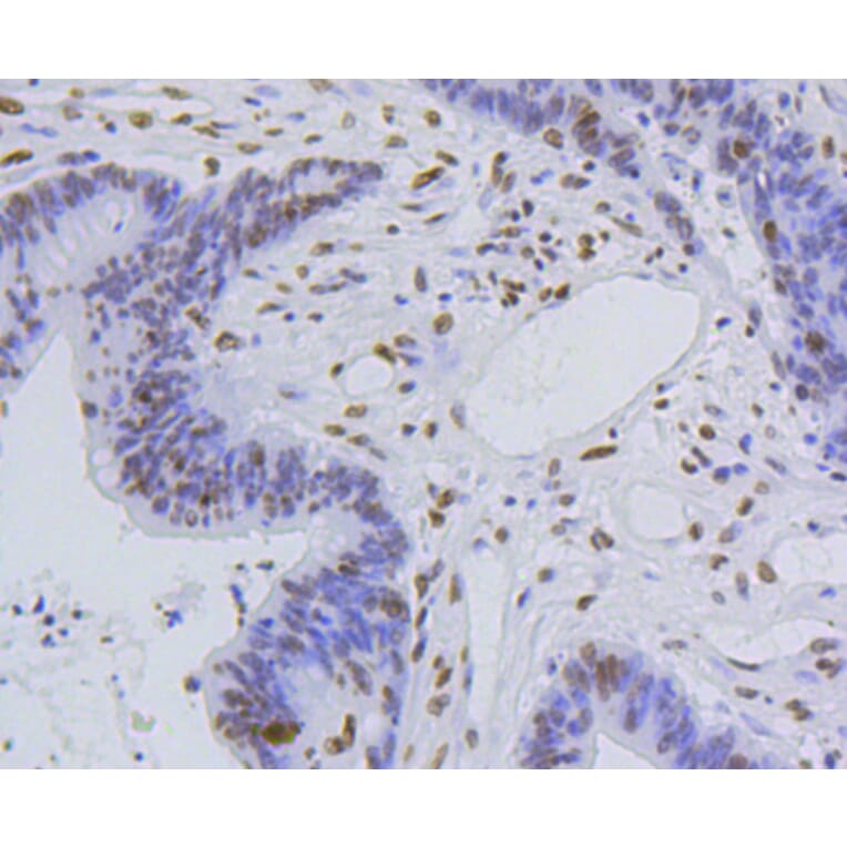 Immunohistochemistry - Anti-Acetyl-Histone H4-K5 mAb Antibody (A11015) - Antibodies.com