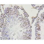 Immunohistochemistry - Anti-Acetyl-Histone H4-K5 mAb Antibody (A11015) - Antibodies.com