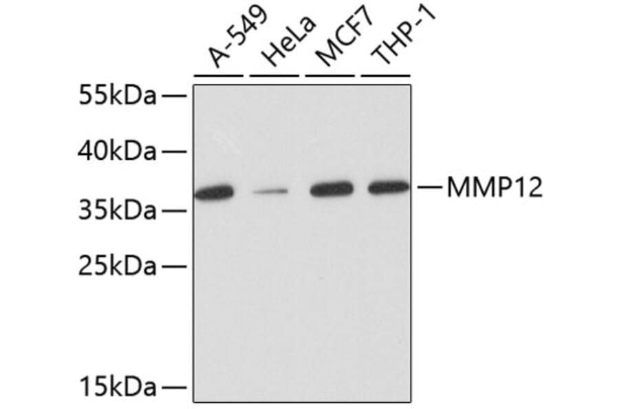 Anti-MMP12 Antibody [Assigned #A11017] (A13193) | Antibodies.com