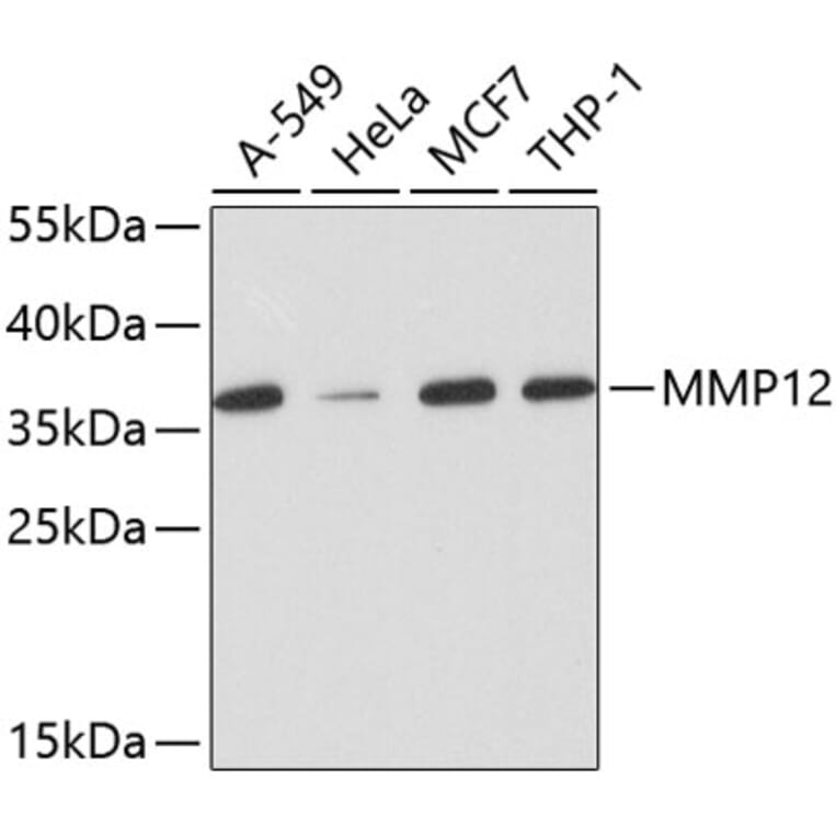 Western Blot - Anti-MMP12 Antibody (A11017) - Antibodies.com
