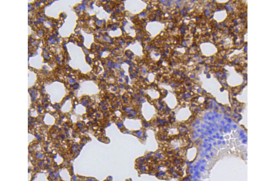 Anti-MMP12 Antibody [Assigned #A11017] (A13193) | Antibodies.com