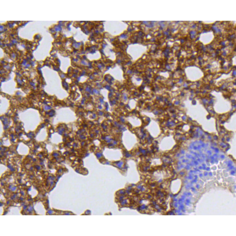 Immunohistochemistry - Anti-MMP12 Antibody (A11017) - Antibodies.com