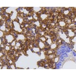 Immunohistochemistry - Anti-MMP12 Antibody (A11017) - Antibodies.com