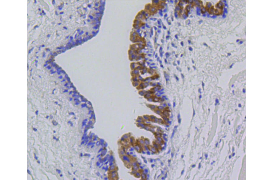 Immunohistochemistry - Anti-MMP12 Antibody (A11017) - Antibodies.com