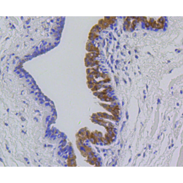 Immunohistochemistry - Anti-MMP12 Antibody (A11017) - Antibodies.com