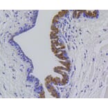 Immunohistochemistry - Anti-MMP12 Antibody (A11017) - Antibodies.com
