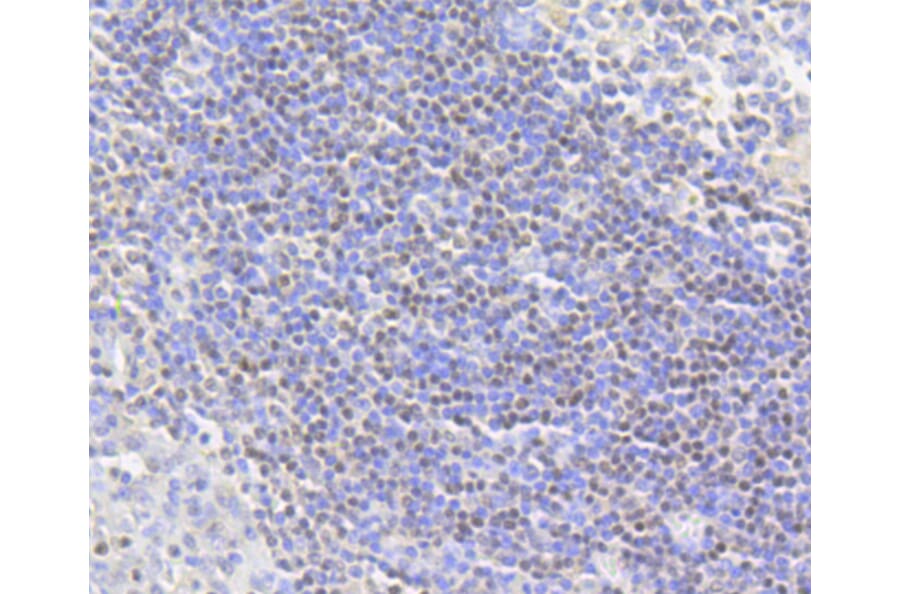 Immunohistochemistry - Anti-Acetyl-Histone H2A-K9 mAb Antibody (A11018) - Antibodies.com