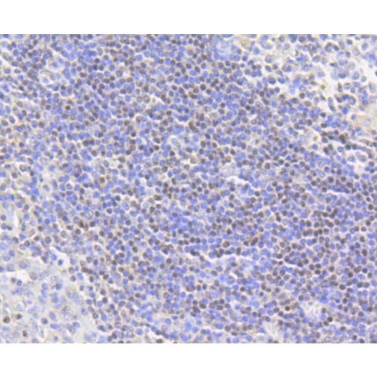 Immunohistochemistry - Anti-Acetyl-Histone H2A-K9 mAb Antibody (A11018) - Antibodies.com