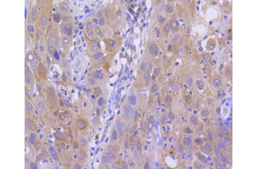 Immunohistochemistry - Anti-Acetyl-Histone H2A-K9 mAb Antibody (A11018) - Antibodies.com