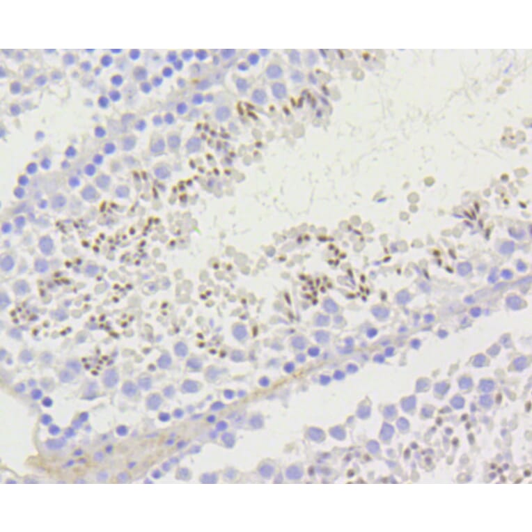 Immunohistochemistry - Anti-Acetyl-Histone H2A-K9 mAb Antibody (A11018) - Antibodies.com