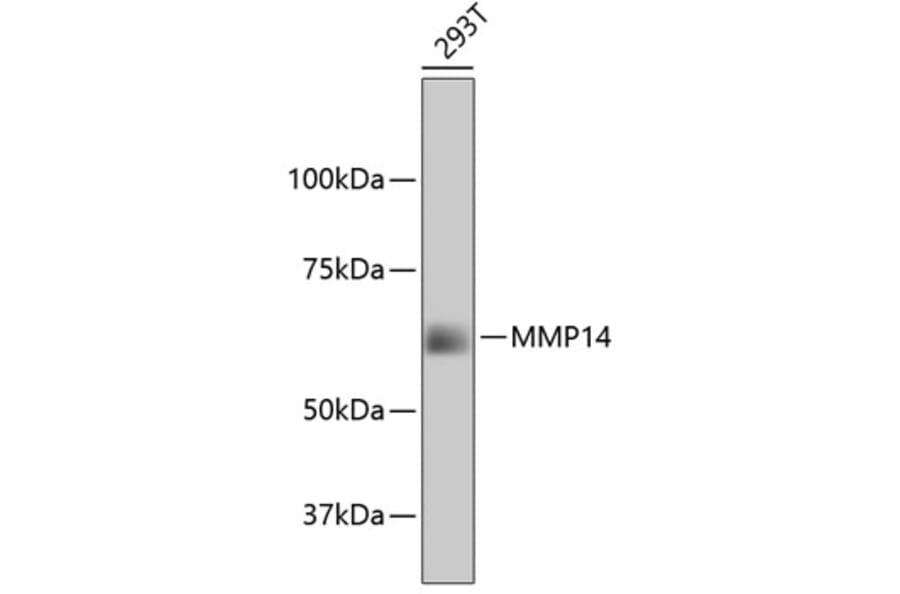 Western Blot - Anti-MMP14 Antibody (A11023) - Antibodies.com