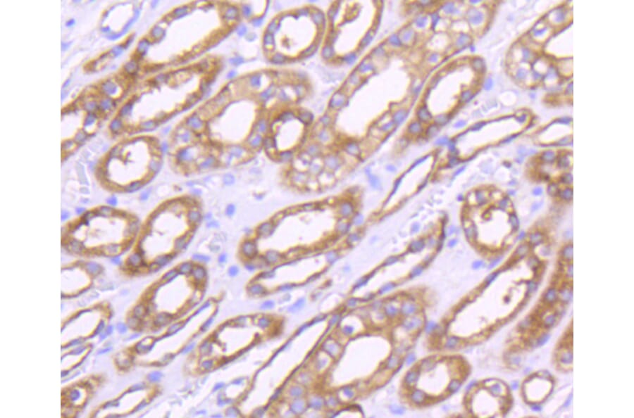 Immunohistochemistry - Anti-MMP14 Antibody (A11023) - Antibodies.com
