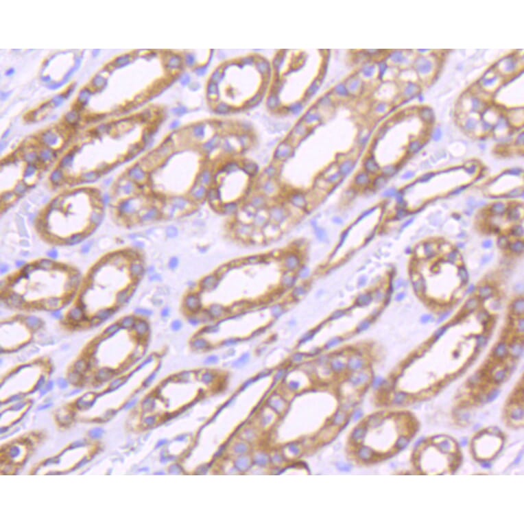 Immunohistochemistry - Anti-MMP14 Antibody (A11023) - Antibodies.com