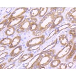 Immunohistochemistry - Anti-MMP14 Antibody (A11023) - Antibodies.com
