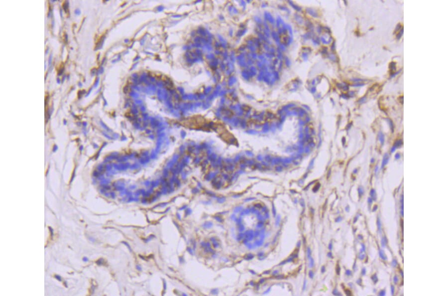 Immunohistochemistry - Anti-MMP14 Antibody (A11023) - Antibodies.com