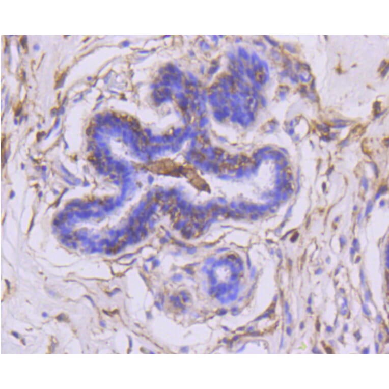 Immunohistochemistry - Anti-MMP14 Antibody (A11023) - Antibodies.com