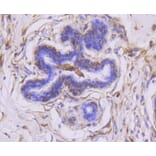 Immunohistochemistry - Anti-MMP14 Antibody (A11023) - Antibodies.com