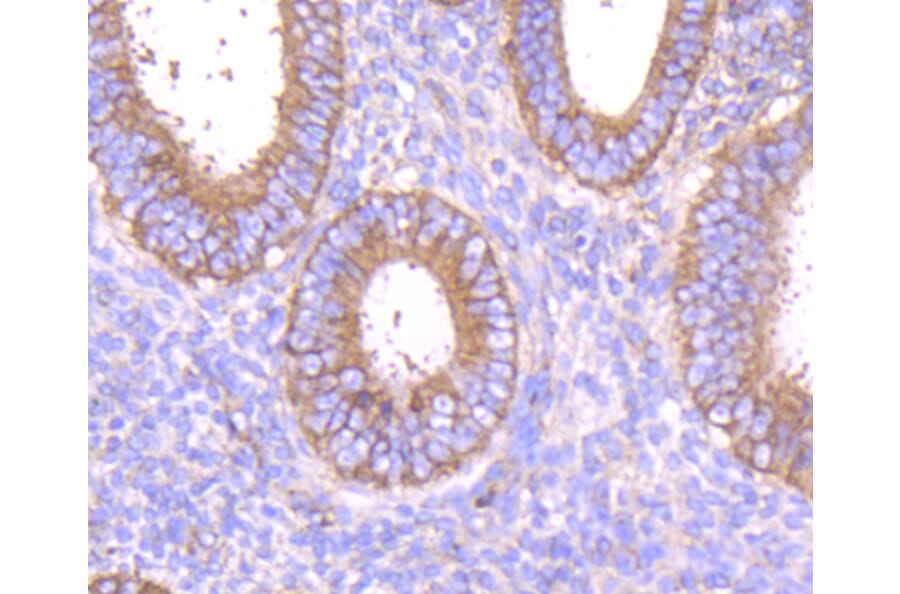Immunohistochemistry - Anti-MMP14 Antibody (A11023) - Antibodies.com