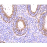 Immunohistochemistry - Anti-MMP14 Antibody (A11023) - Antibodies.com