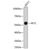 Western Blot - Anti-AKT1 Antibody (A11027) - Antibodies.com