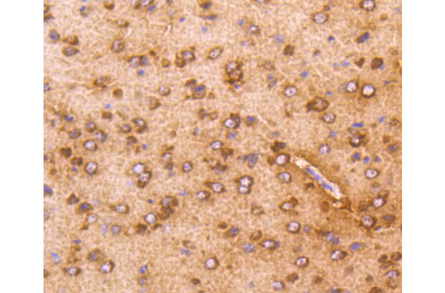 Immunohistochemistry - Anti-AKT1 Antibody (A11027) - Antibodies.com