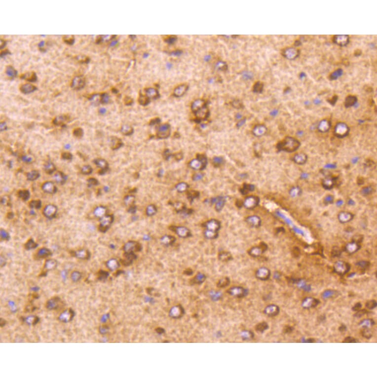 Immunohistochemistry - Anti-AKT1 Antibody (A11027) - Antibodies.com