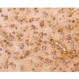 Immunohistochemistry - Anti-AKT1 Antibody (A11027) - Antibodies.com