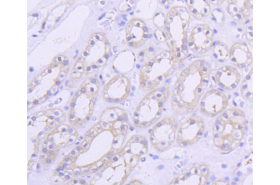 Immunohistochemistry - Anti-AKT1 Antibody (A11027) - Antibodies.com