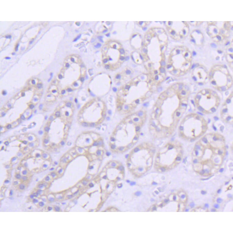 Immunohistochemistry - Anti-AKT1 Antibody (A11027) - Antibodies.com
