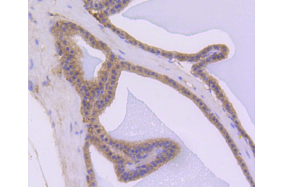 Immunohistochemistry - Anti-AKT1 Antibody (A11027) - Antibodies.com