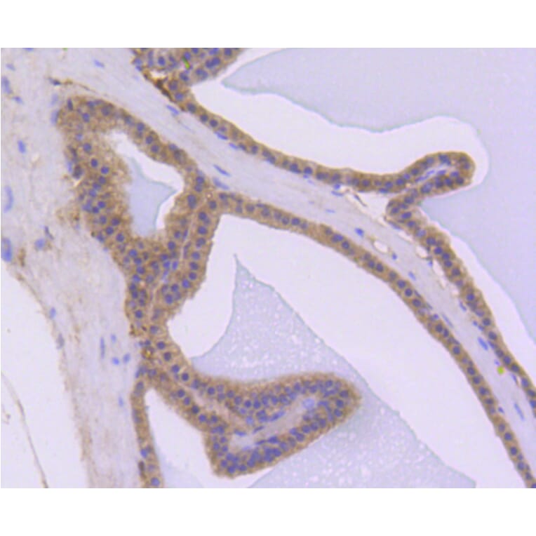 Immunohistochemistry - Anti-AKT1 Antibody (A11027) - Antibodies.com