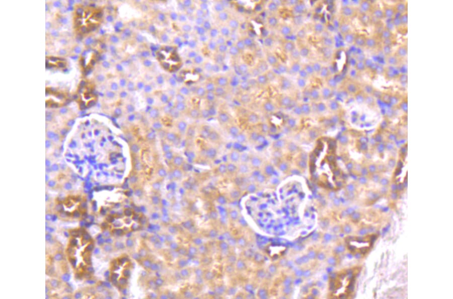 Immunohistochemistry - Anti-AKT1 Antibody (A11027) - Antibodies.com