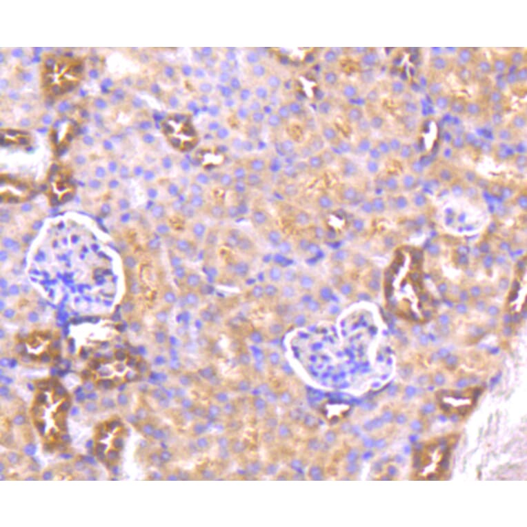 Immunohistochemistry - Anti-AKT1 Antibody (A11027) - Antibodies.com