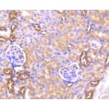 Immunohistochemistry - Anti-AKT1 Antibody (A11027) - Antibodies.com