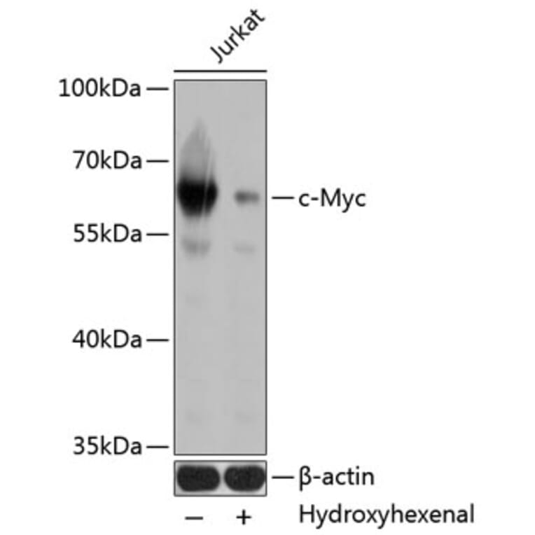 Western Blot - Anti-c-Myc Antibody (A11029) - Antibodies.com