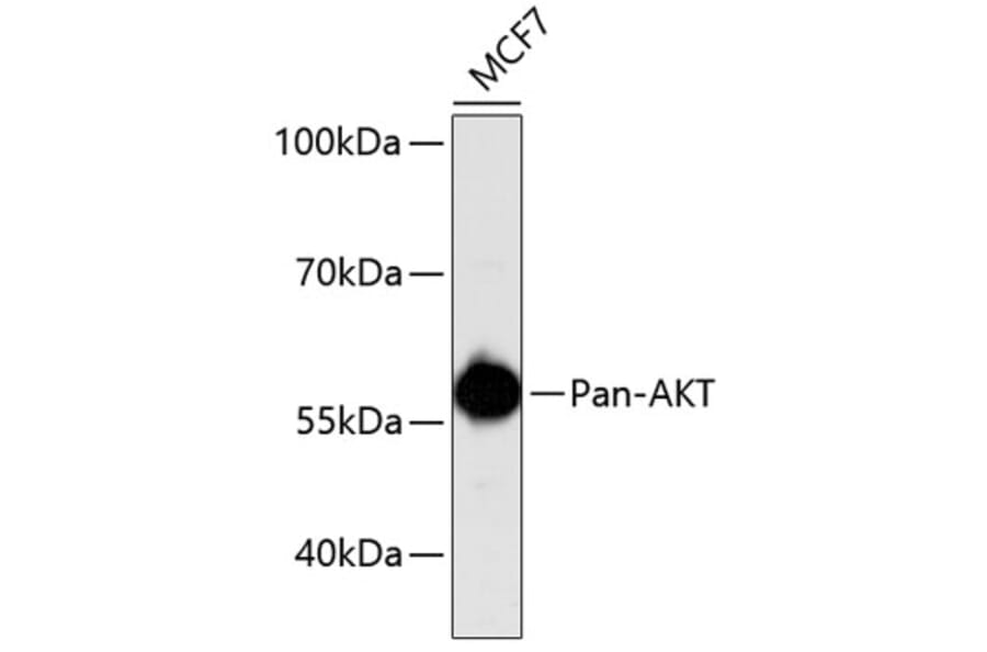 Western Blot - Anti-Pan-AKT Antibody (A11030) - Antibodies.com