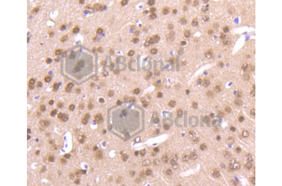 Immunohistochemistry - Anti-Pan-AKT Antibody (A11030) - Antibodies.com