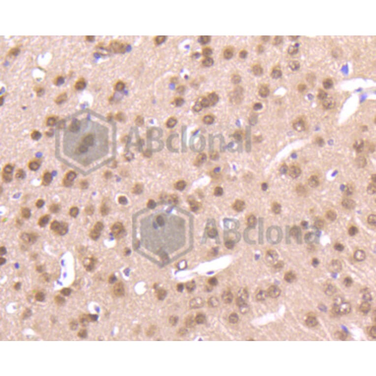 Immunohistochemistry - Anti-Pan-AKT Antibody (A11030) - Antibodies.com