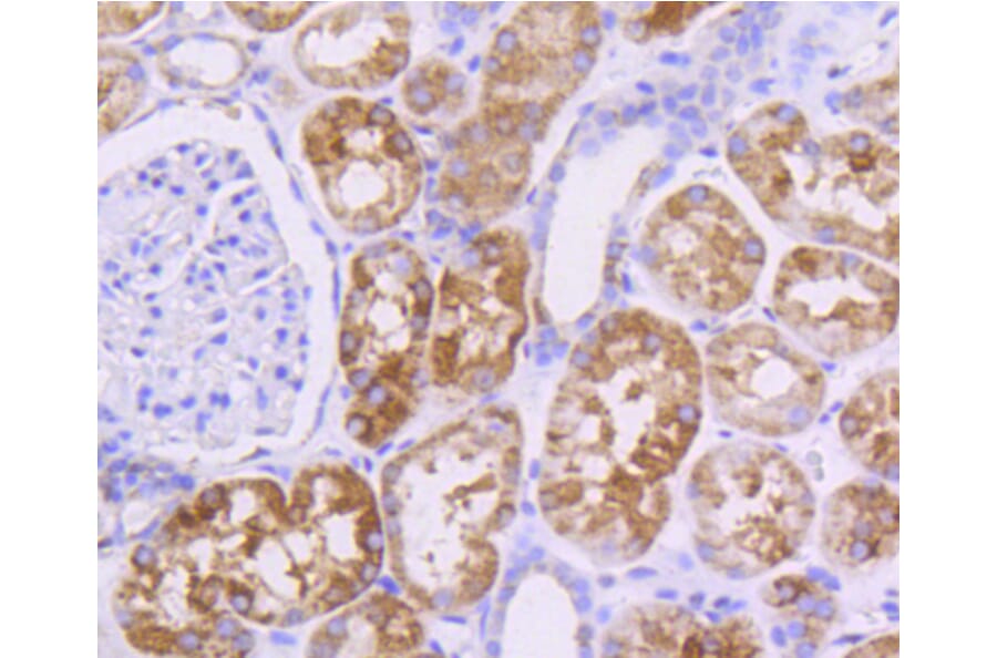 Immunohistochemistry - Anti-Pan-AKT Antibody (A11030) - Antibodies.com