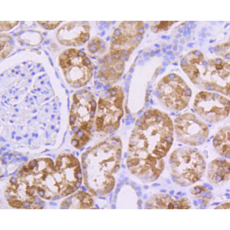 Immunohistochemistry - Anti-Pan-AKT Antibody (A11030) - Antibodies.com