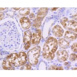 Immunohistochemistry - Anti-Pan-AKT Antibody (A11030) - Antibodies.com