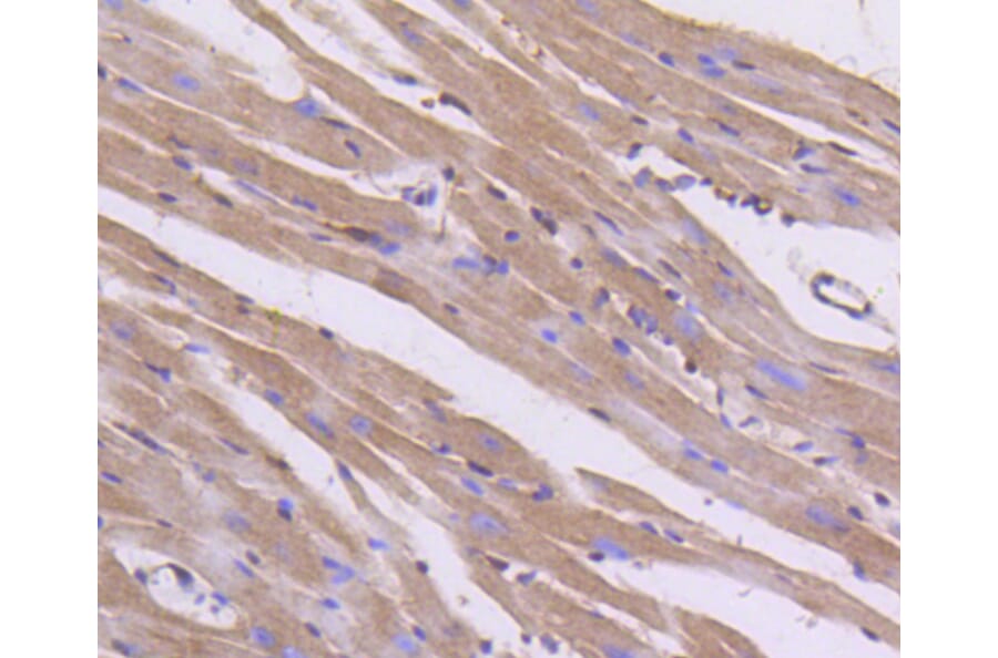 Immunohistochemistry - Anti-Pan-AKT Antibody (A11030) - Antibodies.com