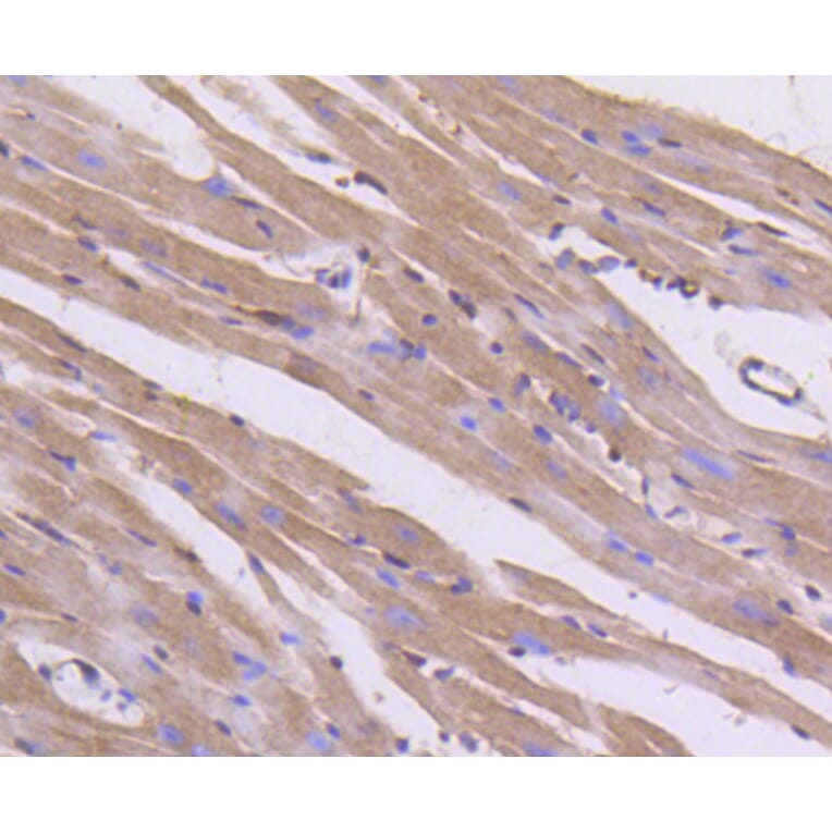 Immunohistochemistry - Anti-Pan-AKT Antibody (A11030) - Antibodies.com