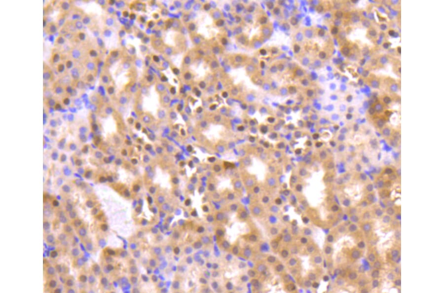 Immunohistochemistry - Anti-Pan-AKT Antibody (A11030) - Antibodies.com