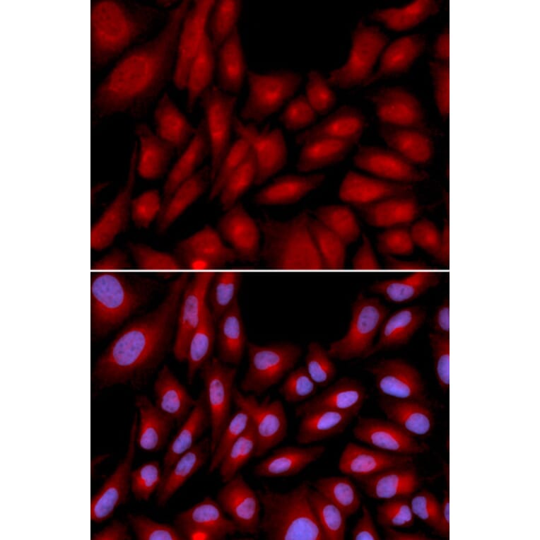 Immunofluorescence - Anti-Bag1 Antibody (A13201) - Antibodies.com