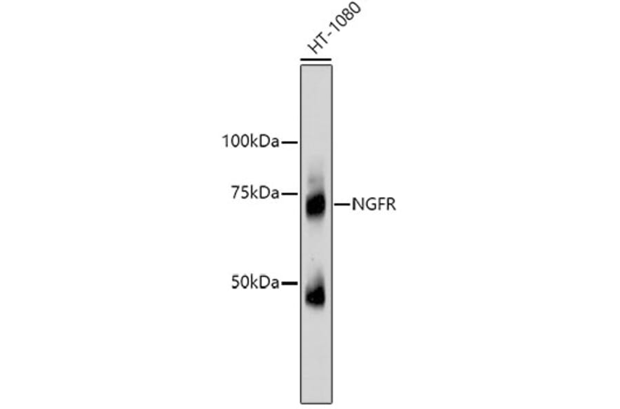 Western Blot - Anti-NGFR Antibody (A11050) - Antibodies.com